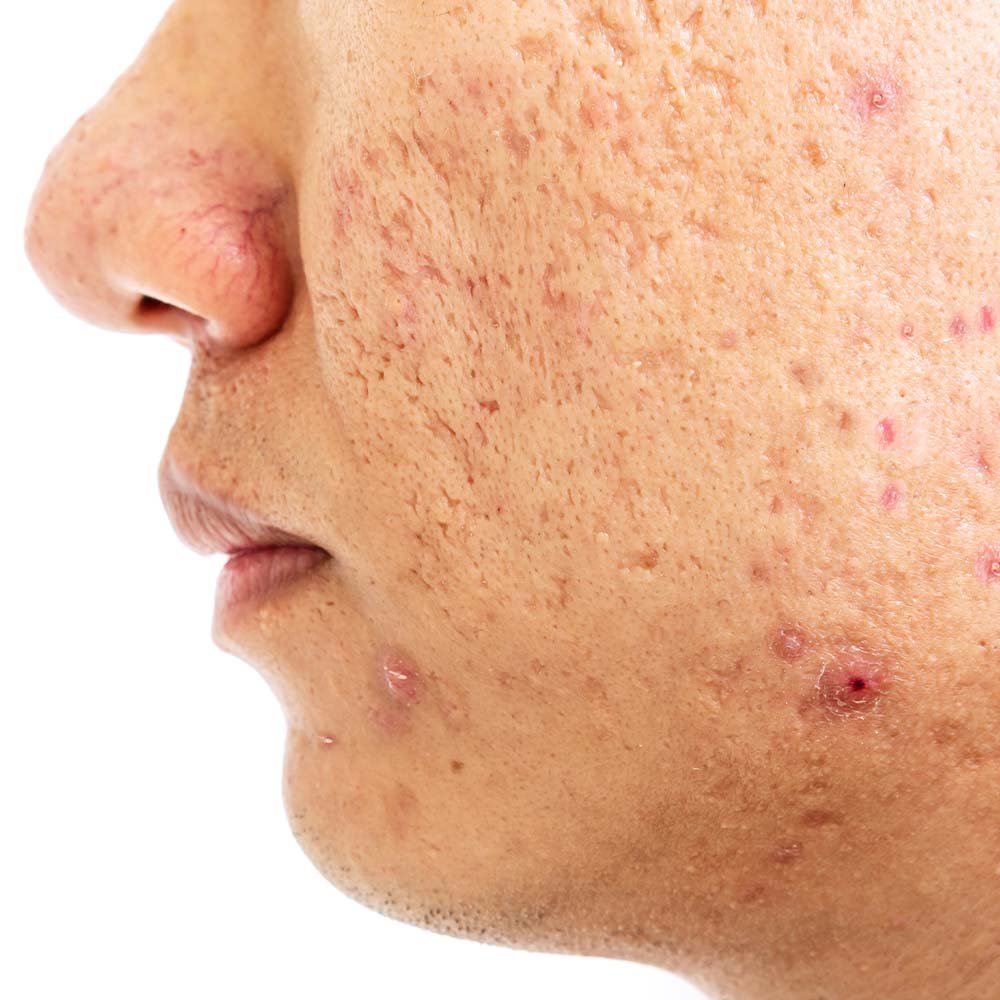 Color-Correction-before